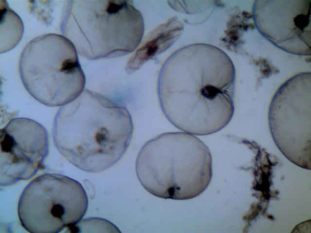 Hình ảnh loài tảo Noctiluca scintillans được soi dưới kính hiển vi