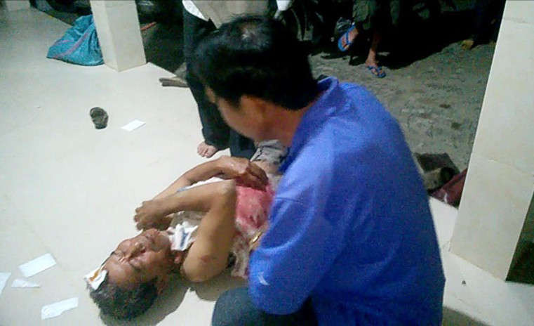Thừa Thiên Huế : Xua đuổi “cát tặc”, người dân bị chém nhập viện