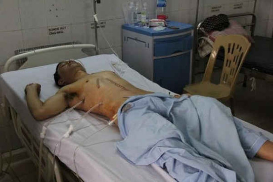 Thanh Hóa: Phó Công an xã bị đâm trọng thương