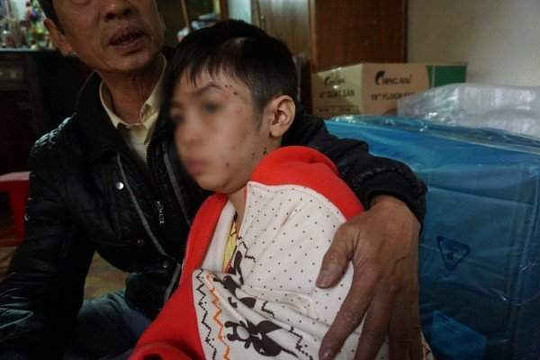 Hà Nội: Khởi tố đôi vợ chồng đánh bé trai 10 tuổi chấn thương sọ não