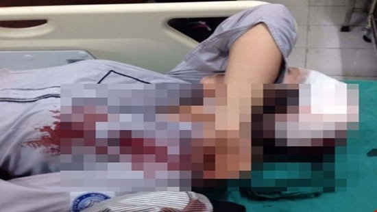Hà Nội: Công an triệu tập 2 thanh niên đánh nữ sinh lớp 10 nhập viện