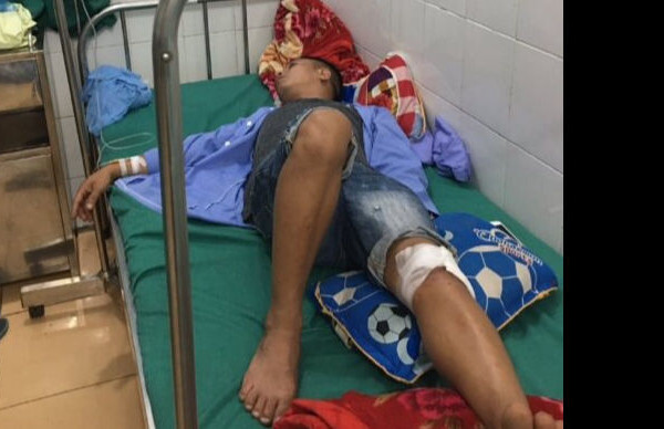 Tủa Chùa - Điện Biên:  Cãi nhau về khách, một lái xe bị chém trọng thương