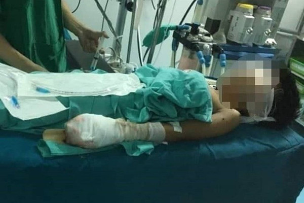 Quảng Trị: Một thiếu niên nhập viện với nhiều vết thương nặng sau tiếng nổ lớn