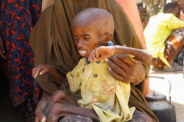 Hạn hán tồi tệ nhất ở Somalia khiến hàng triệu người cần viện trợ