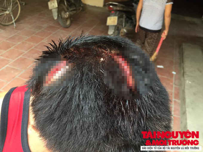Hiệp Hòa - Bắc Giang: Chuyển hồ sơ vụ đánh người dã man ở quán karaoke lên PC45